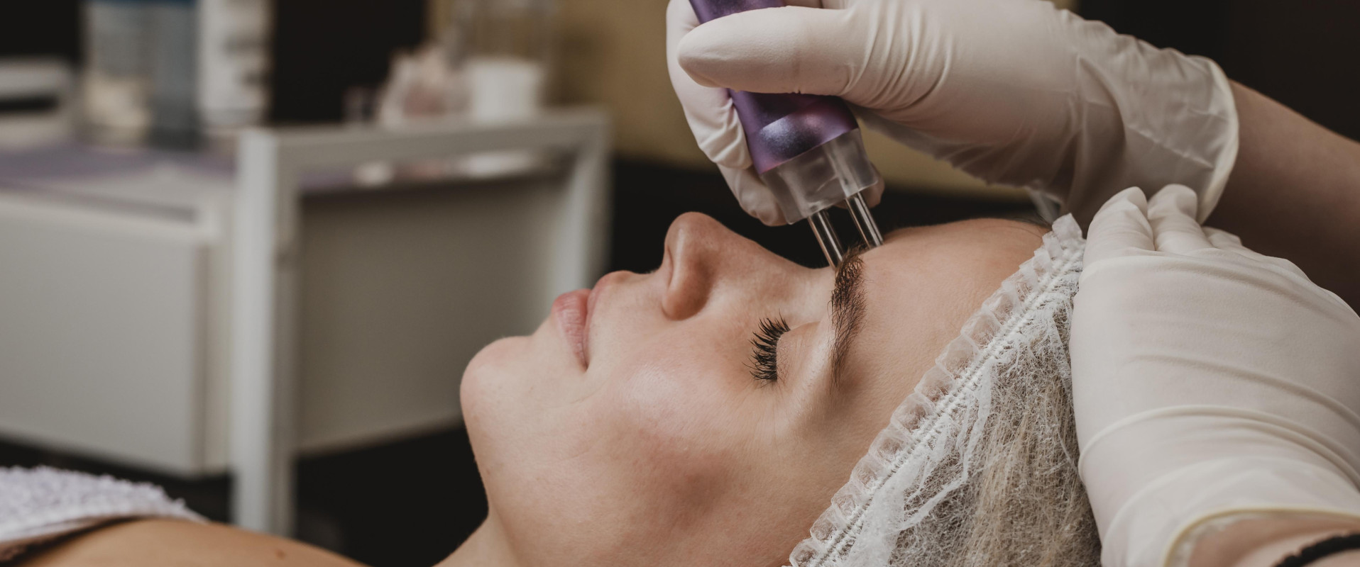 Микроигольчатый лифтинг